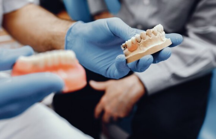 implantes dentales en Sevilla